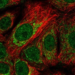 NRDE2 Antibody, Novus Biologicals 0.1mL; Unlabeled:Antibodies, Polyclonal